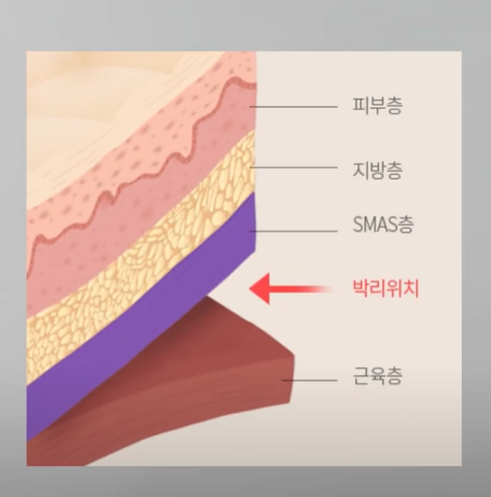 0c980f0c048b9502b848c83de6ab401f_1773105331_1458.png