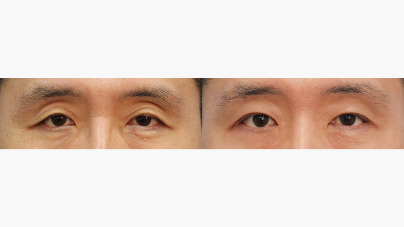 正面