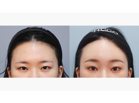 이마거상